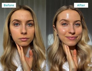 Images showing young woman's skin results before and after using Curél Intensive Moisture Facial Cream